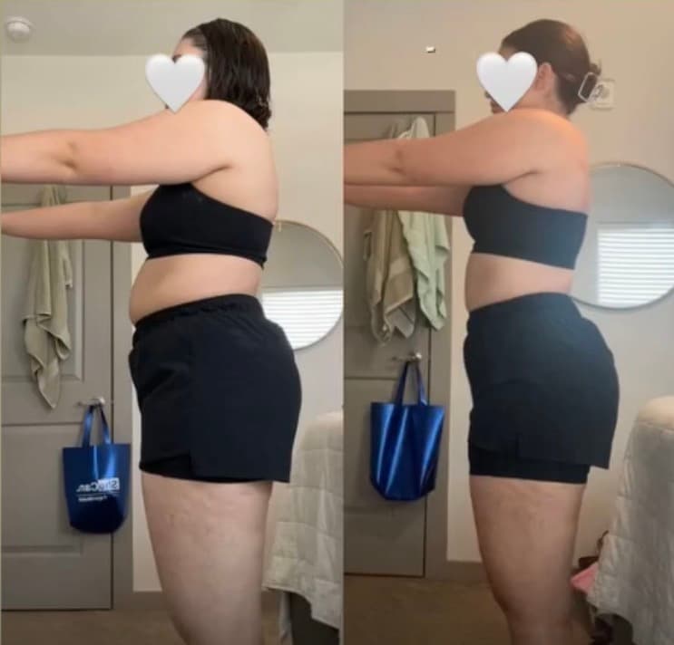 Client before-and-after transformation, side profile