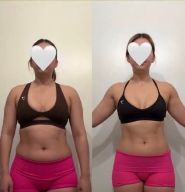 Client before-and-after transformation, front torso view