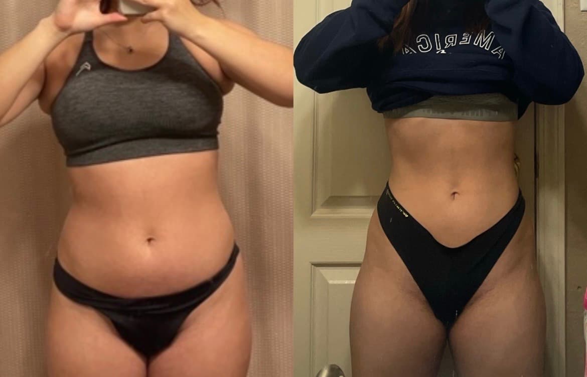 Client before-and-after transformation, front view