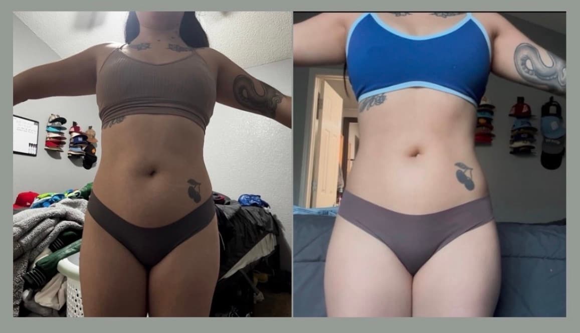 Client before-and-after transformation, front view